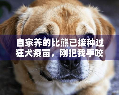 自家养的比熊已接种过狂犬疫苗，刚把我手咬出血了，需要打狂大疫苗吗